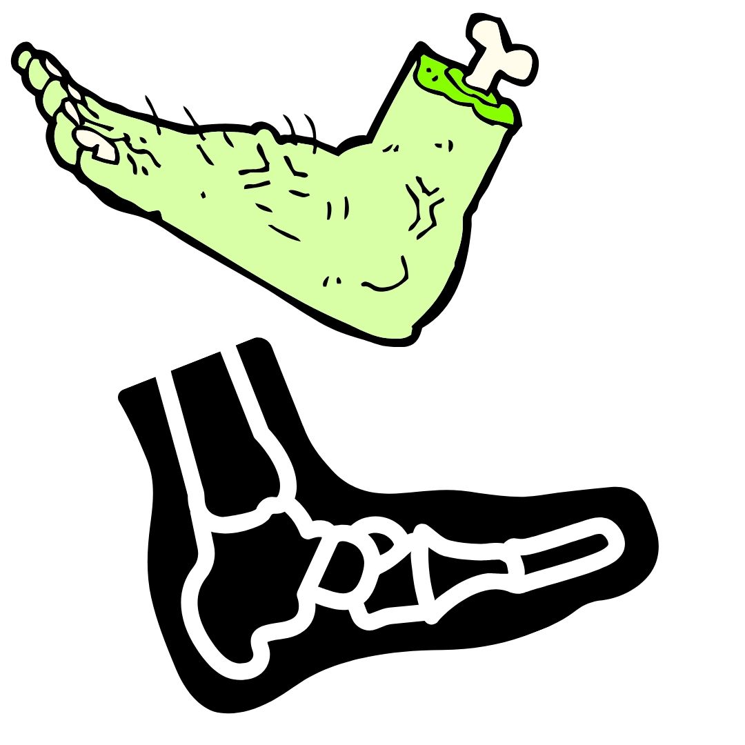 FOOT AND ANKLE